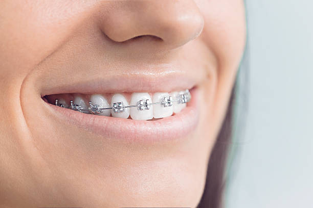 Best Dental Inlays and Onlays  in Wayne, OH